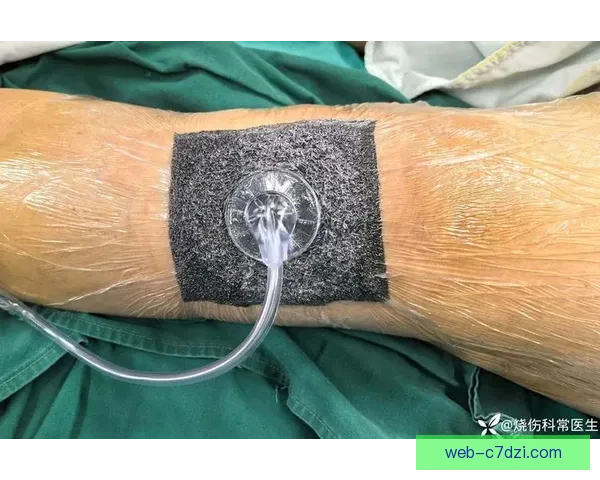 官方通报小贾伦膝部手术复查